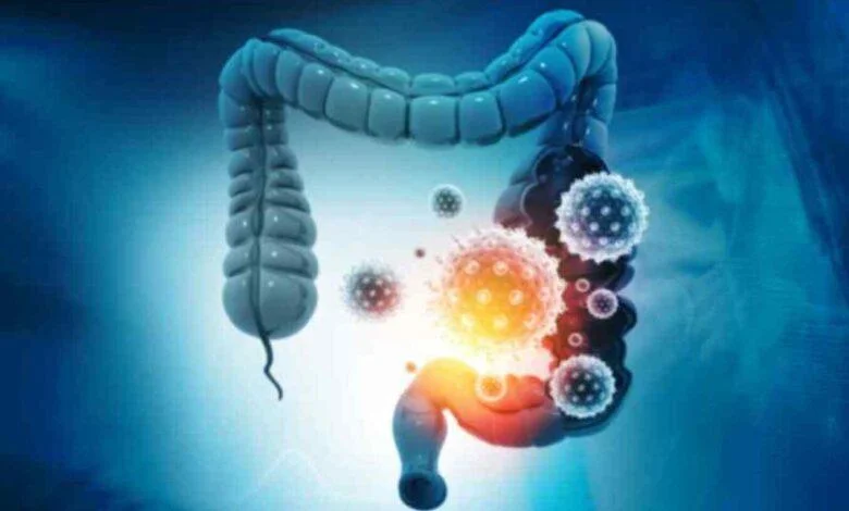 Dickdarm: Symptome, Diagnose und Behandlung 1 Dickdarm-Check 2023: Symptome, Diagnose und Funktionen
