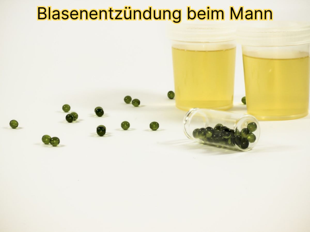 Blasenentzündung beim Mann